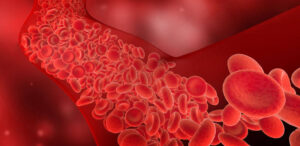 Blood Clots in ITP