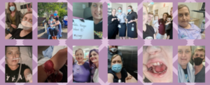 ITP Patient Story - No Spleen Queen